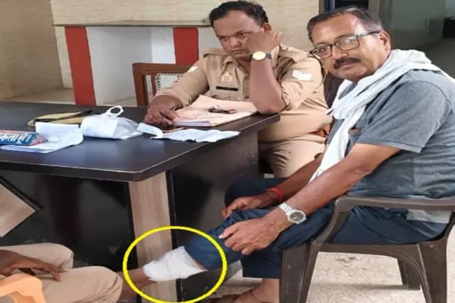 Chandauli News: पागल कुत्ते ने दरोगा सहित दर्जनों ग्रामीणों को काटकर किया लहू लुहान.
