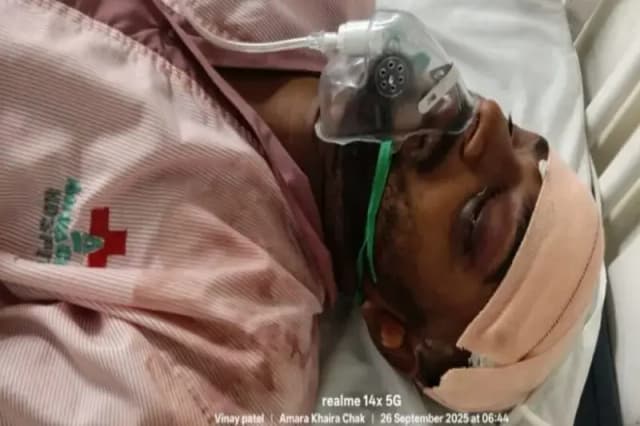 Chandauli News: लिफ्ट लेने के चक्कर में आफत में पड़ी युवक की जान, एसपी के निर्देश पर मुगलसराय कोतवाली में मुकदमा दर्ज. 