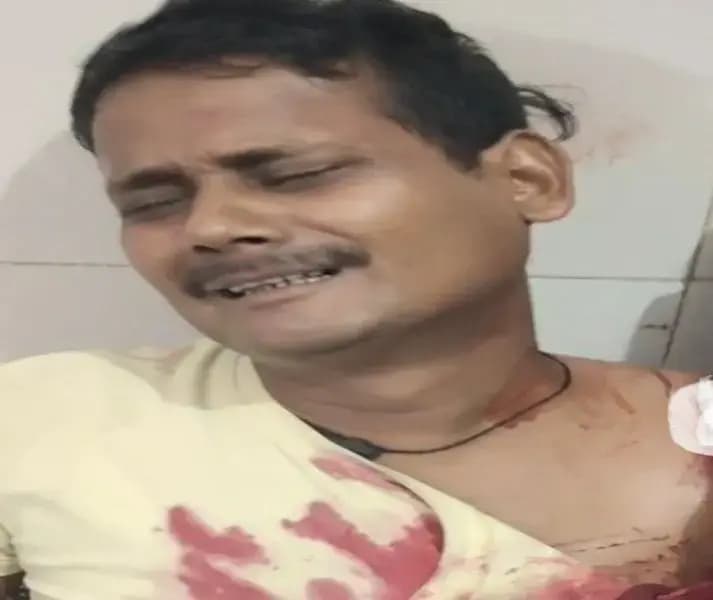 Chandauli News: सड़क दुर्घटना में टोटो सवार युवक गंभीर रूप से घायल,ट्रामा सेंटर रेफर, बिना लाइट-इंडिकेटर वाला ट्रैक्टर बना हादसे का कारन.