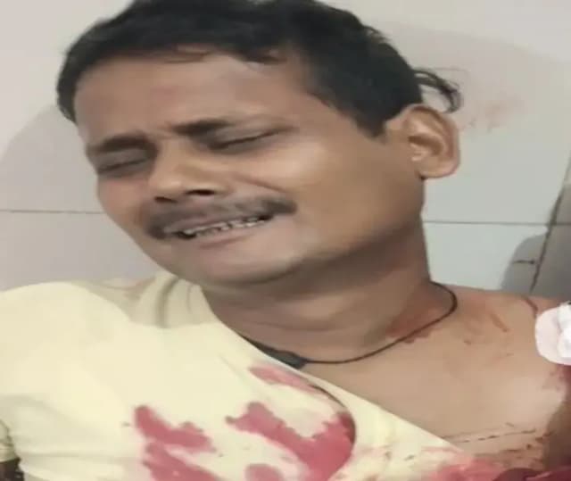 Chandauli News: सड़क दुर्घटना में टोटो सवार युवक गंभीर रूप से घायल,ट्रामा सेंटर रेफर, बिना लाइट-इंडिकेटर वाला ट्रैक्टर बना हादसे का कारन.
