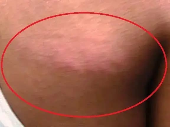 Sonbhadra News: बकाया फीस को लेकर प्रधानाचार्य ने 12वीं के छात्र की बेरहमी से की पिटाई, मामला पहुंचा डीएम दरबार.