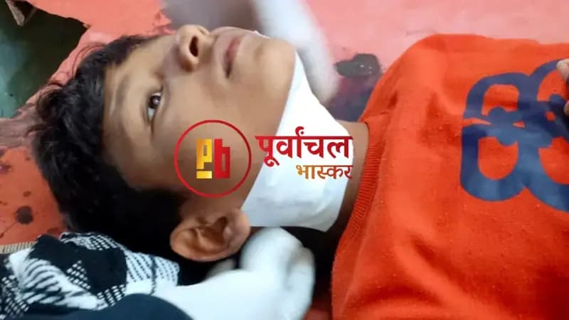 Chandauli News: चाइनीज मांझे से कटी बच्चे की गर्दन, मफलर ने बचाई जान.
