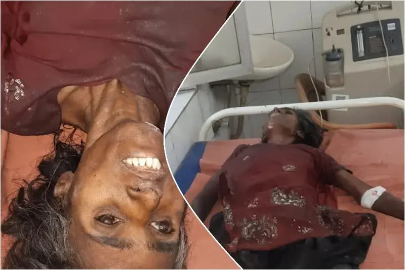 Sonbhadra News: चोपन में अज्ञात महिला की मौत, पुलिस पहचान में जुटी.