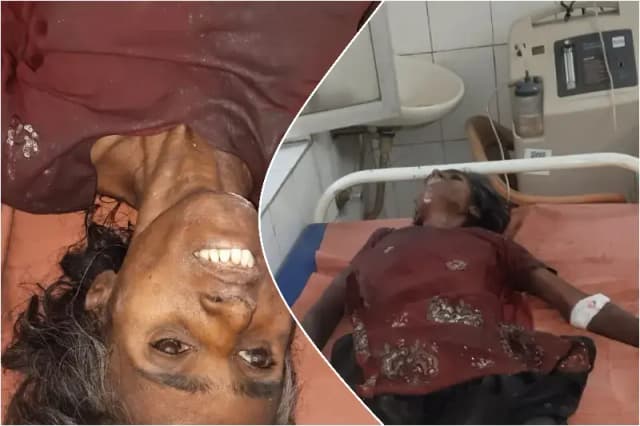 Sonbhadra News: चोपन में अज्ञात महिला की मौत, पुलिस पहचान में जुटी.