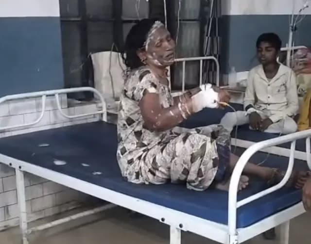 Sonbhadra News: दुद्धी में गैस लीकेज जांचना पड़ा महंगा, माचिस जलाने पर महिला बुरी तरह झुलसी, जिला अस्पताल रेफर.