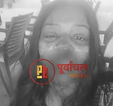 Chandauli News: लहूलुहान हालत में थाने पहुंची महिला, सास-ससुर पर जानलेवा हमले का आरोप.
