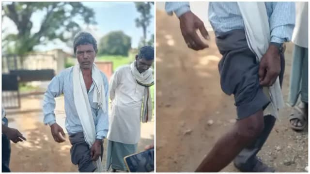 Sonbhadra News: स्वास्थ्य कर्मियों पर मारपीट का आरोप लगाने वाले ग्रामीण अब बैकफुट पर.