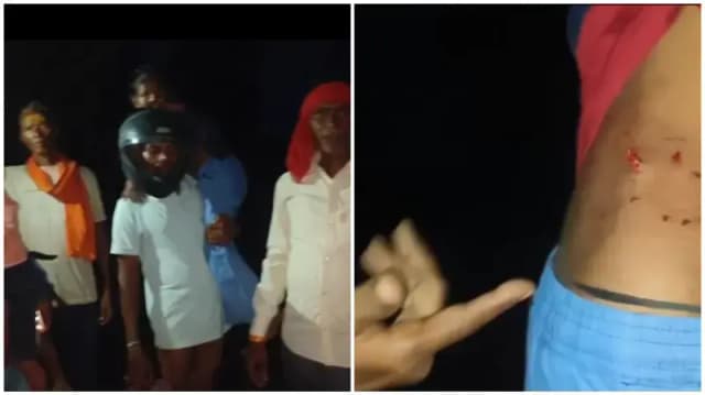 Sonbhadra News: कुत्ते के काटने के बाद अस्पताल जाने को तरसते रहे मासूम, जलमग्न रास्ते ने रोकी राह.