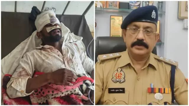 Sonbhadra News: ओबरा में दो पक्षों में खूनी संघर्ष, 9 से 10 घायल! दो की हालत गंभीर.