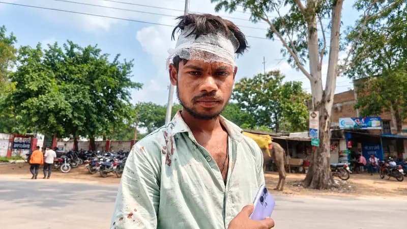 Sonbhadra News: बभनी में पत्नी के विवाद में बीच-बचाव करने पहुंचे साले की पिटाई, सिर में आई गंभीर चोट.