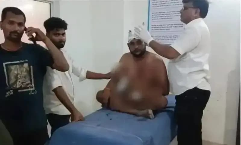 Chandauli News: दुकान पर सामान खरीदने को लेकर विवाद, दो पक्षों में मारपीट, सात घायल.
