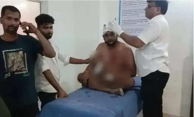 Chandauli News: दुकान पर सामान खरीदने को लेकर विवाद, दो पक्षों में मारपीट, सात घायल.
