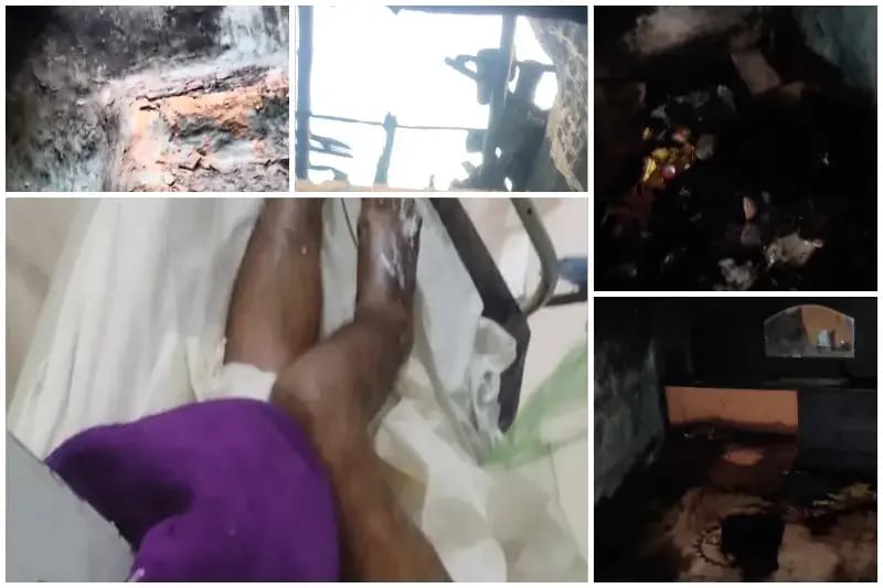 Sonbhadra News: शॉर्ट सर्किट से घर में लगी आग, आगजनी की घटना में युवक गंभीर रूप से झुलसा.