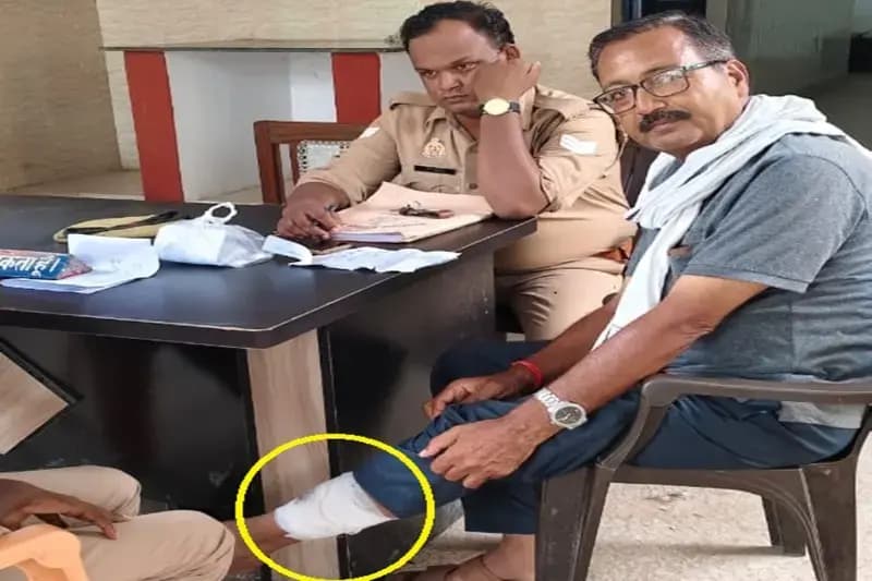 Chandauli News: पागल कुत्ते ने दरोगा सहित दर्जनों ग्रामीणों को काटकर किया लहू लुहान.