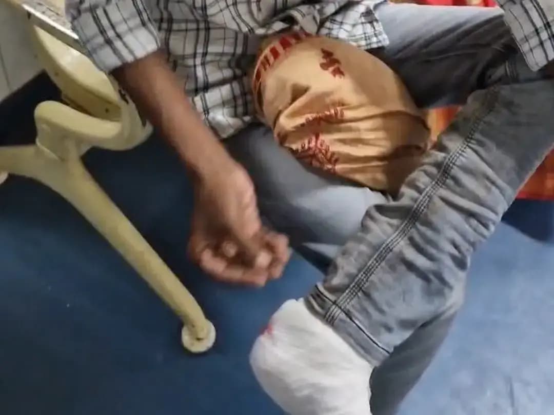 Img