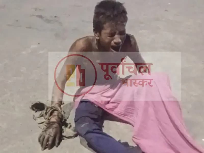 Sonbhadra News: मालगाड़ी के ऊपर हाई टेंशन तार से झुलसा युवक, कुछ बच्चों के साथ खेलते समय हुआ हादसा, वाराणसी रेफर.