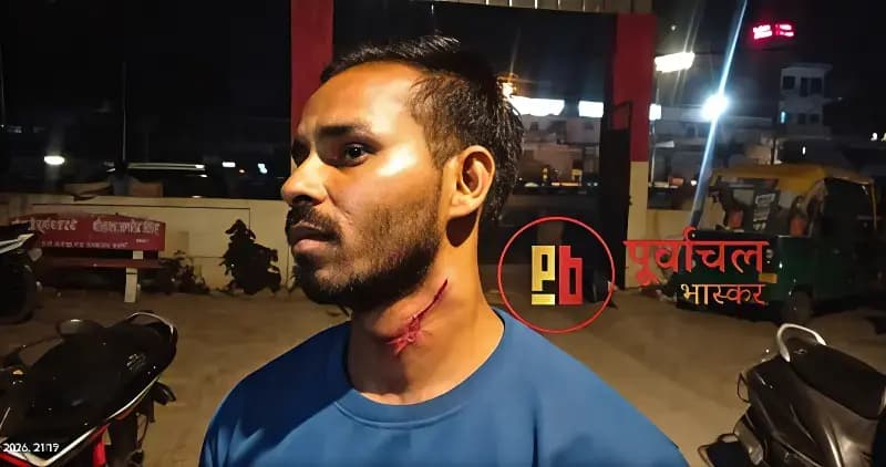 Chandauli News: रफ्तार रोकने पर युवक पर जानलेवा हमला, धारदार हथियार से गर्दन पर वार.