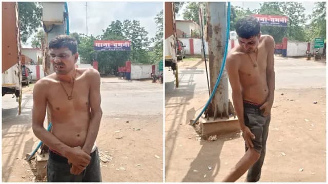 Sonbhadra News: जमीनी विवाद में भाई ने भाई को पीटा, लाठी-डंडे के हमले में हाथ टूटा.