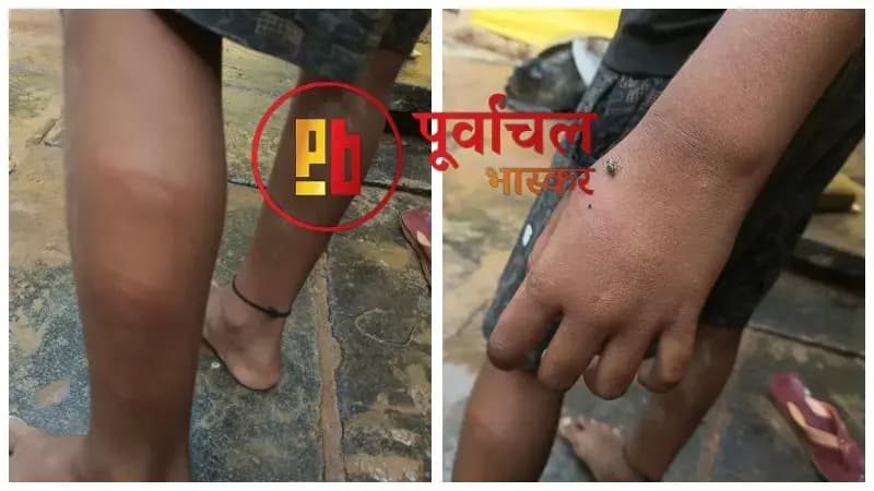 Chandauli News: प्राथमिक विद्यालय में दलित छात्र की पिटाई का आरोप, शिक्षक पर कार्रवाई की मांग.