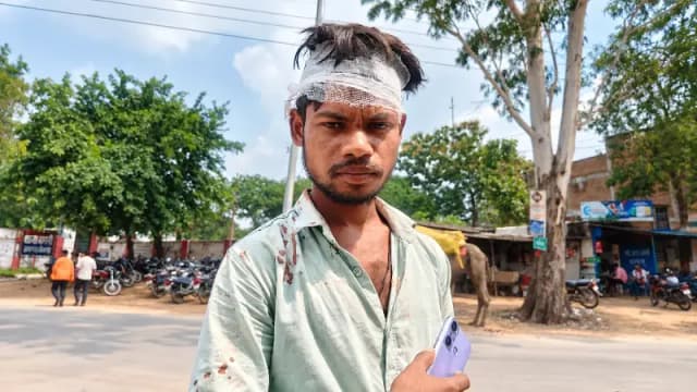 Sonbhadra News: बभनी में पत्नी के विवाद में बीच-बचाव करने पहुंचे साले की पिटाई, सिर में आई गंभीर चोट.