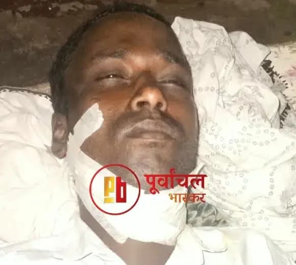Chandauli News: शौच के लिए निकले युवक पर बाइक सवार दो नकाबपोशों ने किया हमला, जांच में जुटी पुलिस.