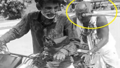 प्रधान के पिता पर हमले में आंख में धसी कुल्हाड़ी