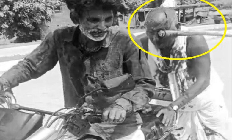 प्रधान के पिता पर हमले में आंख में धसी कुल्हाड़ी
